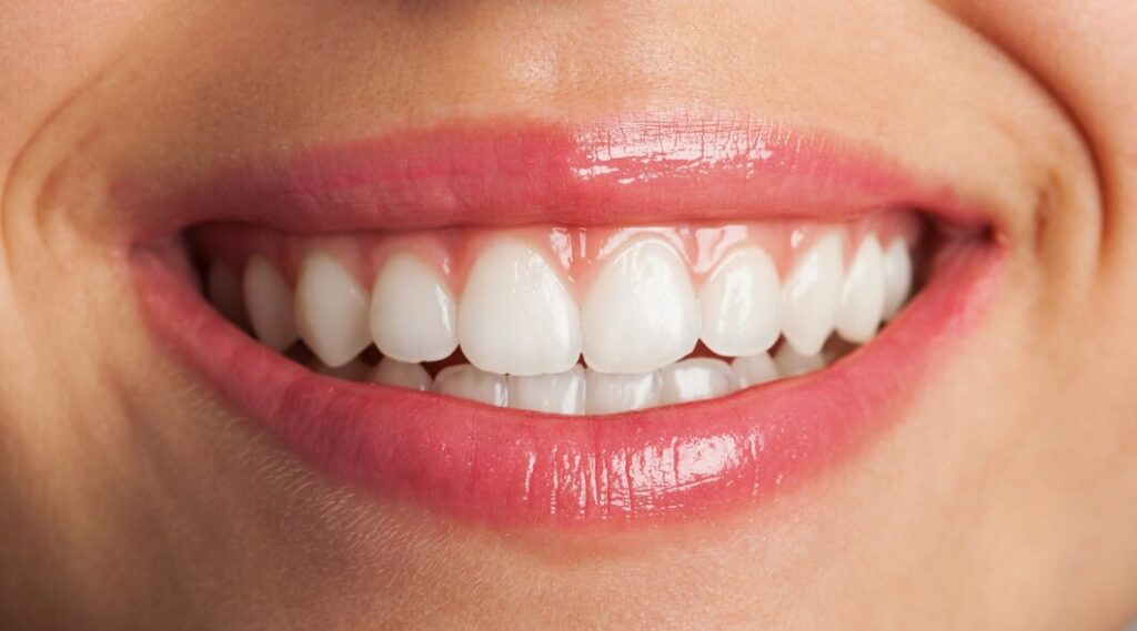 Unlocking the Power of a Brighter Smile — Why Teeth Whitening Matters More Than You Think